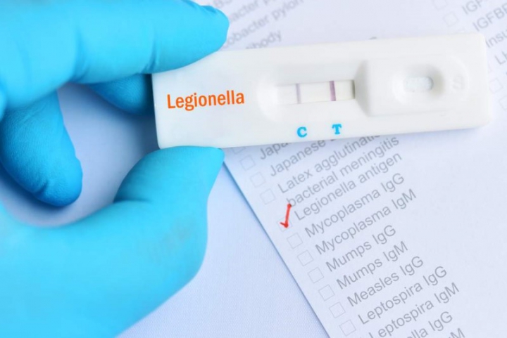 Legionella, un webinar su come riaprire in sicurezza le attività ricettive