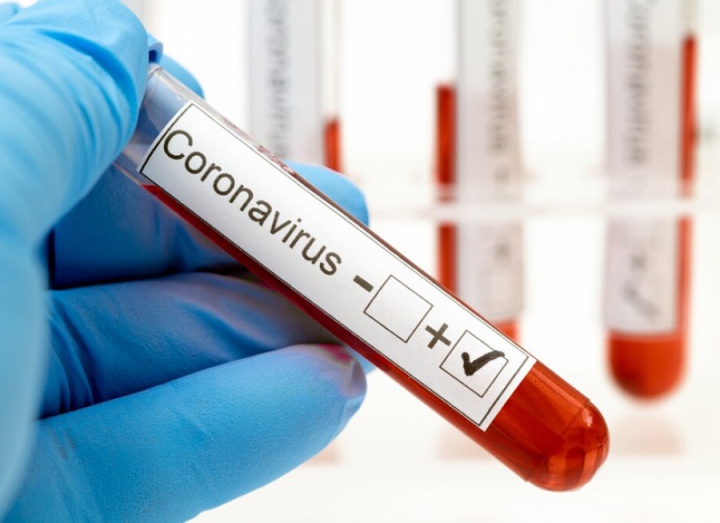 Coronavirus, Avantinsieme chiede chiarezza sui numeri dei contagi in Liguria